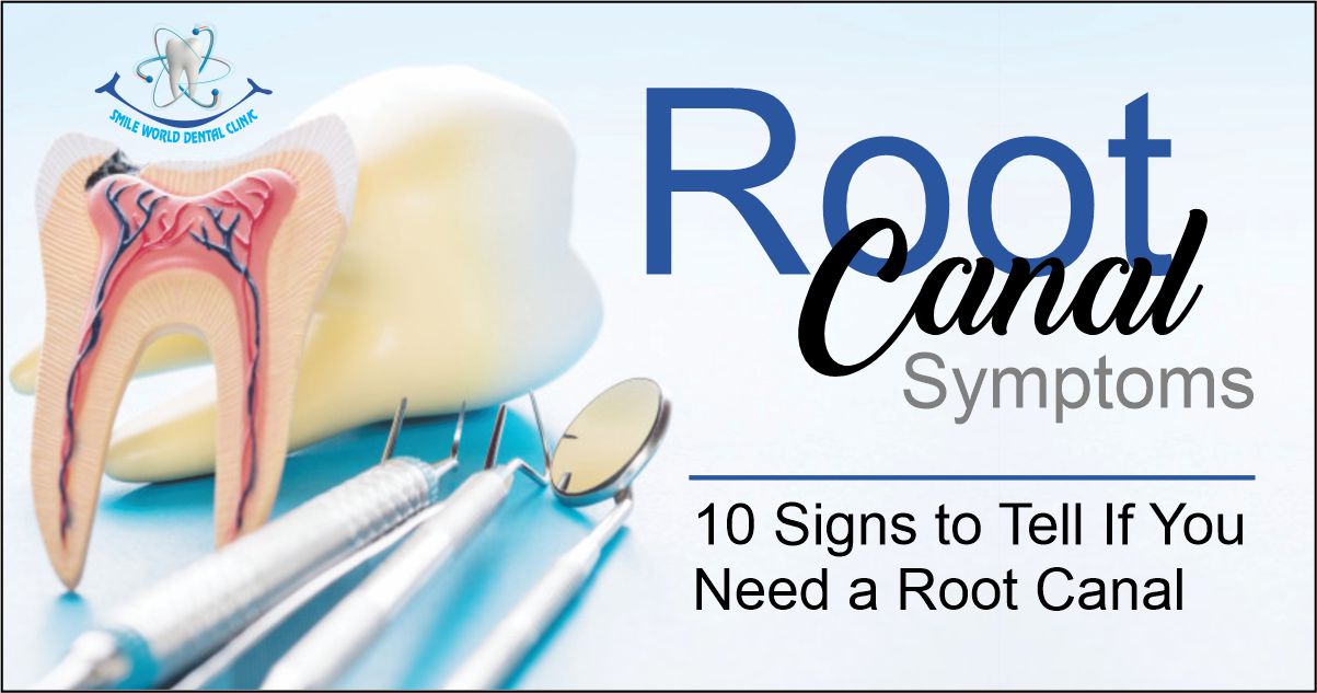 Root Canal Symptoms