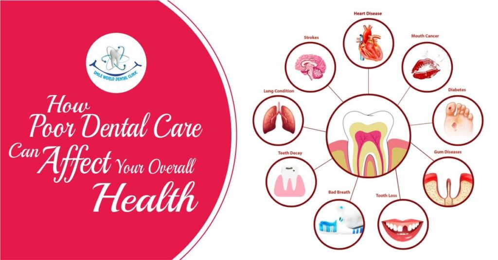 Poor Dental Care Can Affect Your Overall Health